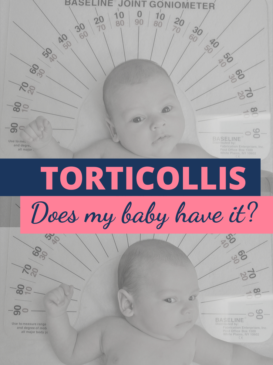 Torticollis - Pediatric Physical Therapy